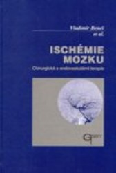 Ischémie mozku | BENEŠ, Vladimír