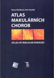 Atlas makulárních chorob | SOUČEK, Petr, CIHELKOVÁ, Ilona