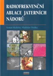 Radiofrekvenční ablace jaterních nádorů | TŘEŠKA, Vladislav, SKALICKÝ, Tomáš